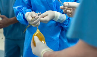 Penile Augmentation-All Procedures