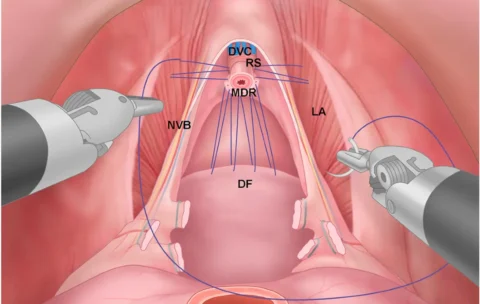 Robotic Radical Prostatectomy Course