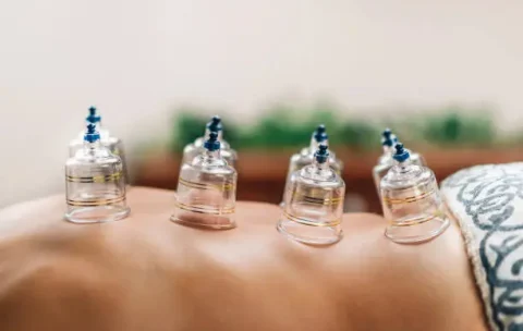 hijama